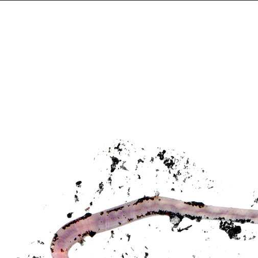 worm